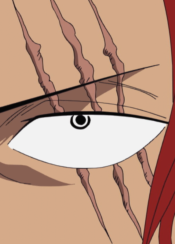 Shanks'_Scars.png